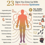 23 Signs You Grew Up With Ehlers-Danlos Syndrome