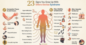 23 Signs You Grew Up With Ehlers-Danlos Syndrome